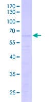 Human HIST1H1E Protein (Recombinant GST)