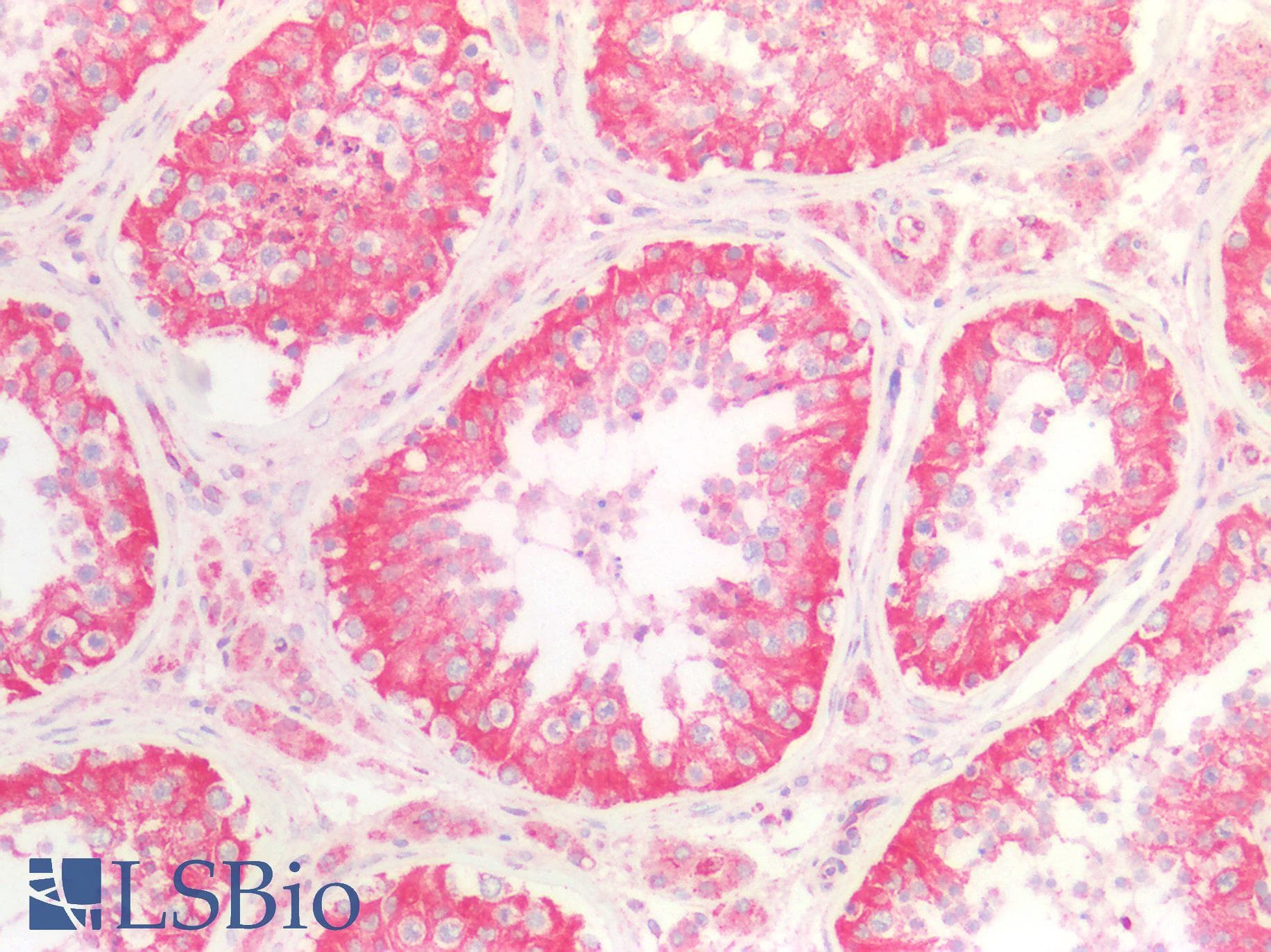 IHC-plus™ PTGES2 Antibody