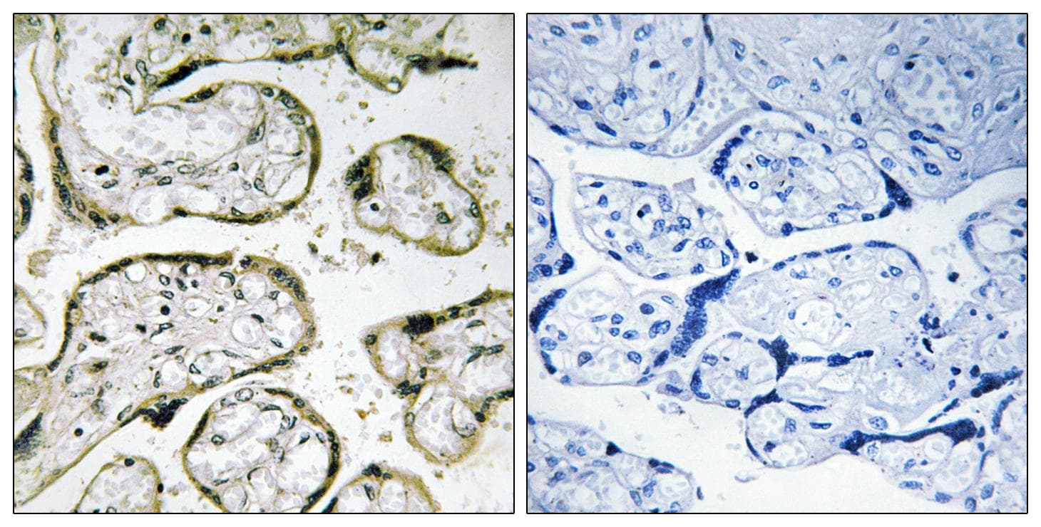 MRPL42 / MRPS32 Antibody
