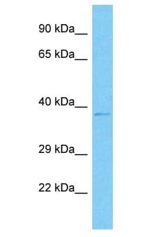 MAPK3 / ERK1 Antibody (aa8-57)