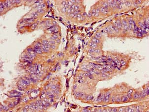 PROKR2/Prokineticin Receptor 2 Antibody