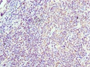 CCND3 / Cyclin D3 Antibody (aa1-292)