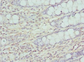 Polyclonal Rabbit anti-Human CCP110 Antibody (IHC, WB)