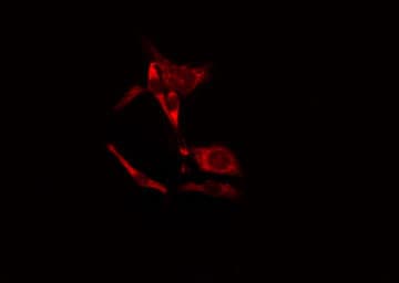 Polyclonal Rabbit anti-Human PEAK1 / SGK269 Antibody (IF, WB)