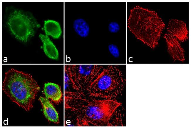 Monoclonal Mouse anti-Human FSH Antibody (clone P4G2, IF)