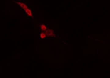Polyclonal Rabbit anti-Human DNAJB4 Antibody (IF, WB)