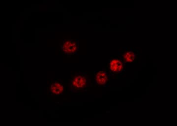 Polyclonal Rabbit anti-Human ELP2 / STATIP1 Antibody (IHC, IF, WB)