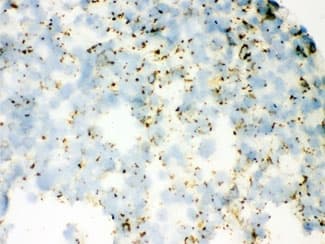 Polyclonal Rabbit anti-Human SFTPA1 + SFTPA2 Antibody (IHC, WB)