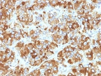 CHGA / Chromogranin A Antibody (clone CHGA/798)