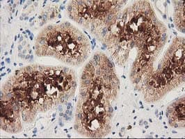 Monoclonal Mouse anti-Human HDAC6 Antibody (clone OTI5E6, IHC, IF, WB)