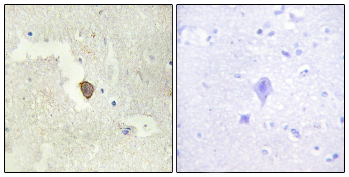 Polyclonal Rabbit anti-Human ADCY7 / Adenylate Cyclase 7 Antibody (aa191-240, IHC, IF)
