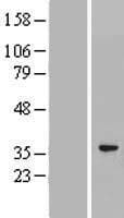 Human GLUP / PACRG Protein (Over-Expression Lysate Myc-DDK (Flag))