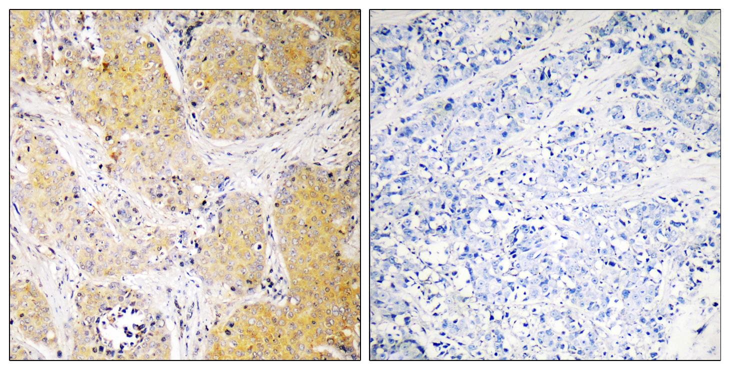 Polyclonal Rabbit anti-Human SERPING1 / C1 Inhibitor Antibody (IHC, WB)