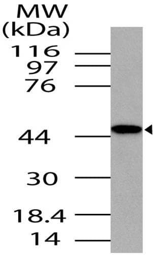 TARBP2 / TRBP2 Antibody (aa150-366)