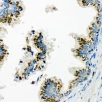 Polyclonal Rabbit anti-Human HERC3 Antibody (IHC, WB)