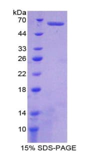 Human EFNB2 / Ephrin B2 Protein (Recombinant His-GST)