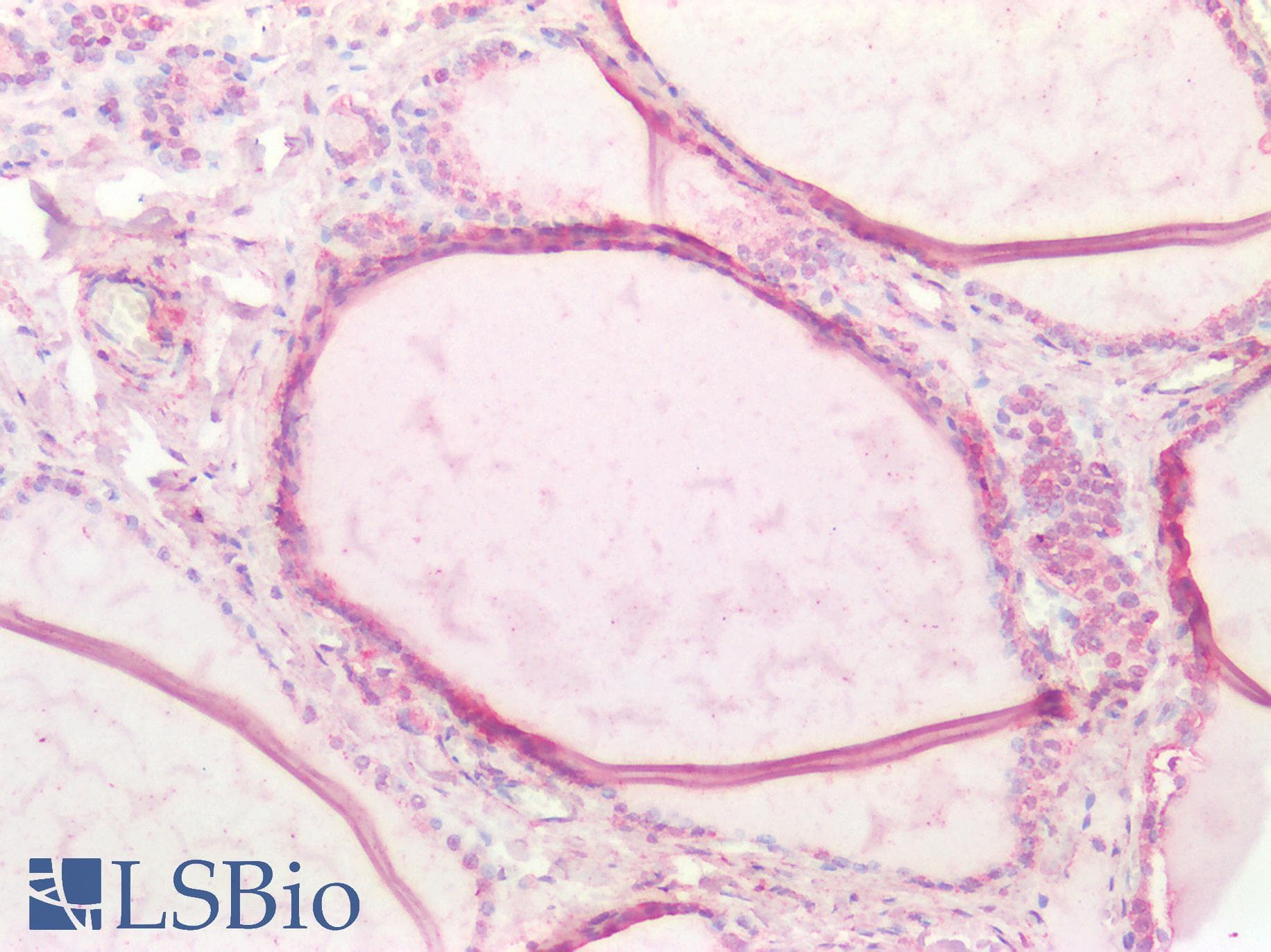 IHC-plus™ Polyclonal Goat anti-Human CTSB / Cathepsin B Antibody (Internal Region, IHC, IF)