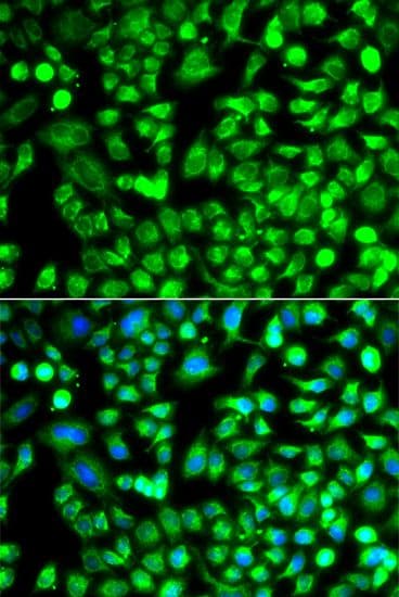 ALKBH4 Antibody