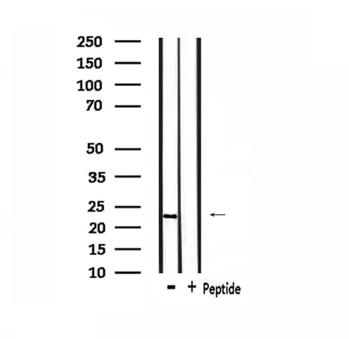 Polyclonal Rabbit anti-Human Recoverin Antibody (IF, WB)