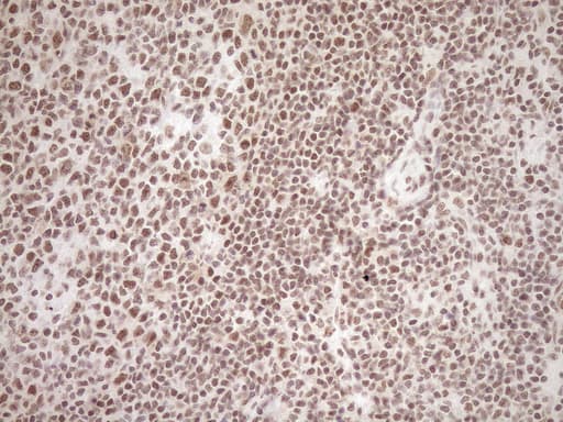 EXOSC1 / CSL4 Antibody (clone OTI1H9)