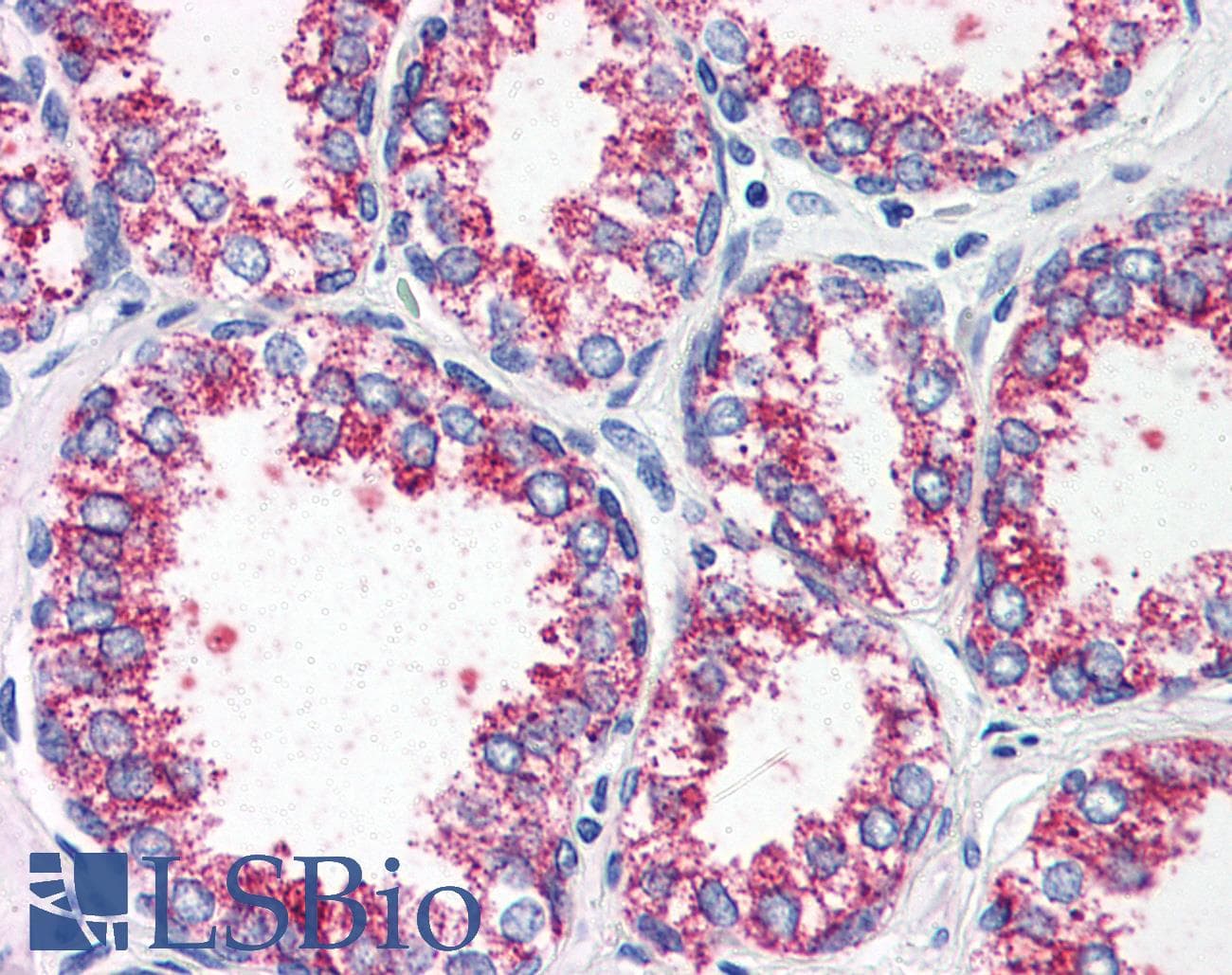 IHC-plus™ CCKAR / CCK1R Antibody (Internal)