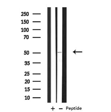 Polyclonal Rabbit anti-Human TMEM237 / ALS2CR4 Antibody (IF, WB)