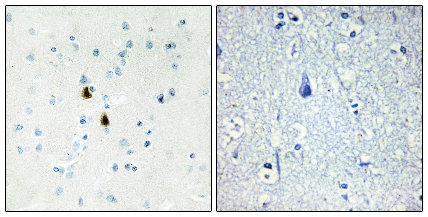 PKIA Antibody