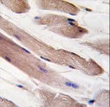 PIK3R1 / p85 Alpha Antibody (Tyr580)