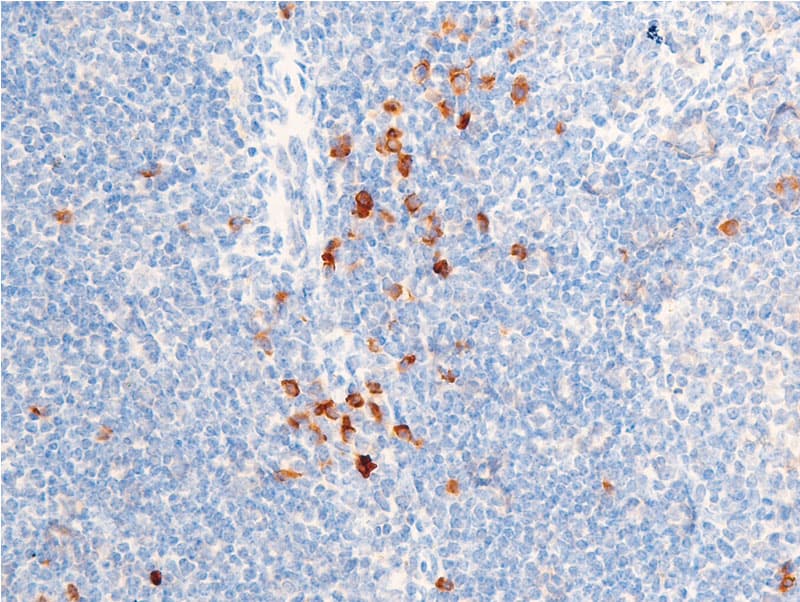 CHEK1 / CHK1 Antibody (phospho-Ser301)