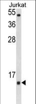 Polyclonal Rabbit anti-Human SOD1 / Cu-Zn SOD Antibody (aa55-84, IHC, IF, WB)