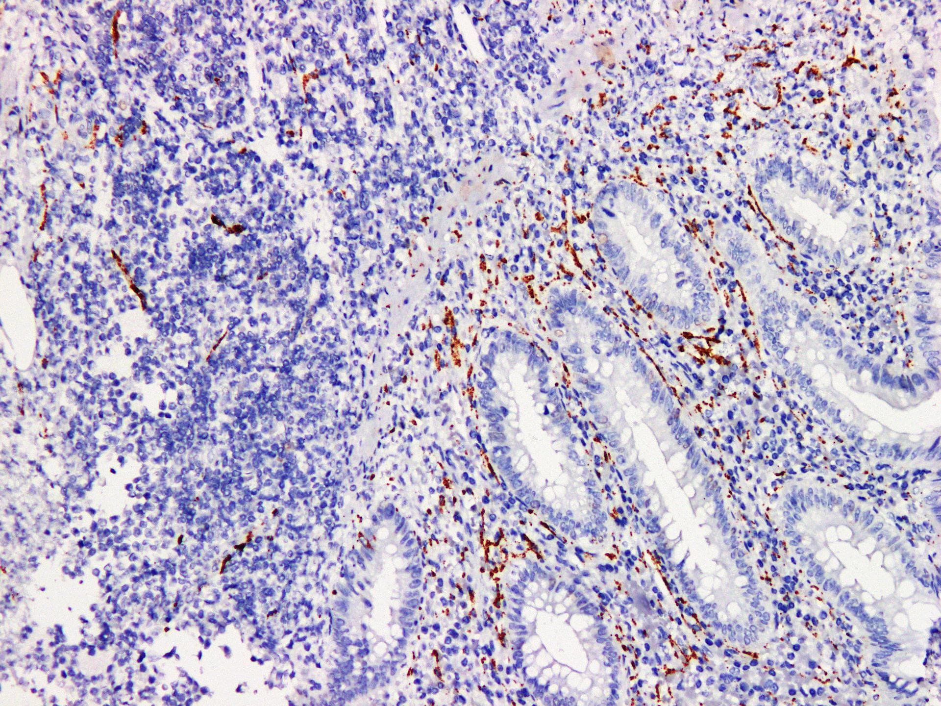 SYP / Synaptophysin Antibody