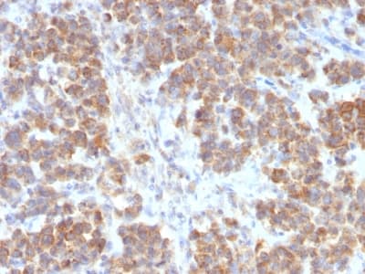 Recombinant Monoclonal Rabbit anti-Human TNFSF15 / TL1A / VEGI Antibody (clone VEGI/2052R, IHC)