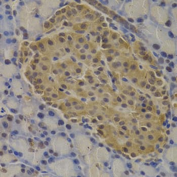 MECOM / EVI1 Antibody