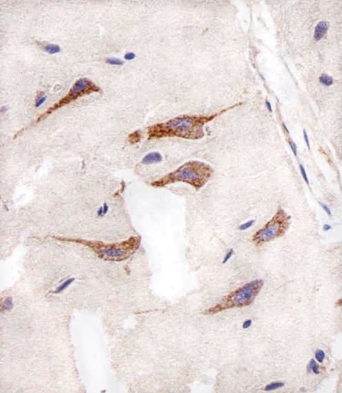 AURKA / Aurora-A Antibody (clone 1364CT291.108.155)