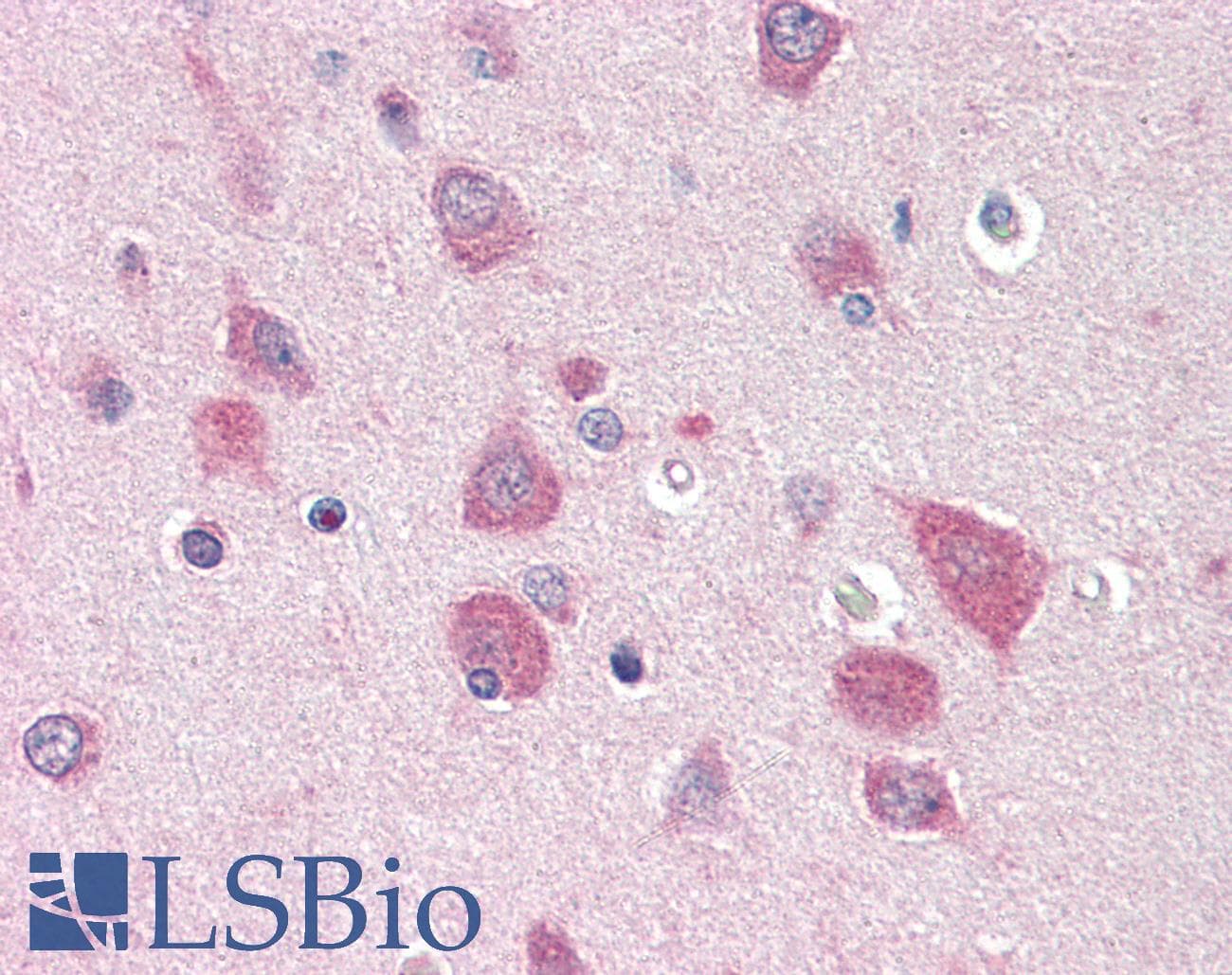 IHC-plus™ Polyclonal Rabbit anti-Human MYO5B / Myosin VB Antibody (C-Terminus, IHC, WB)