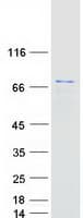 Human PPP2R5D Protein (Recombinant Myc-DDK (Flag))