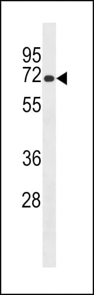 LRMP / JAW1 Antibody (aa403-431)