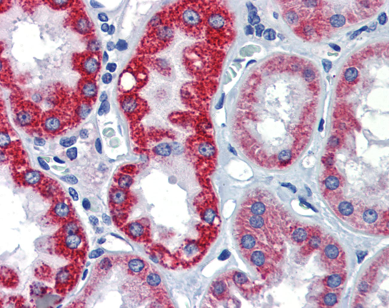 PathPlus™ EGR2 Antibody (aa397-446)