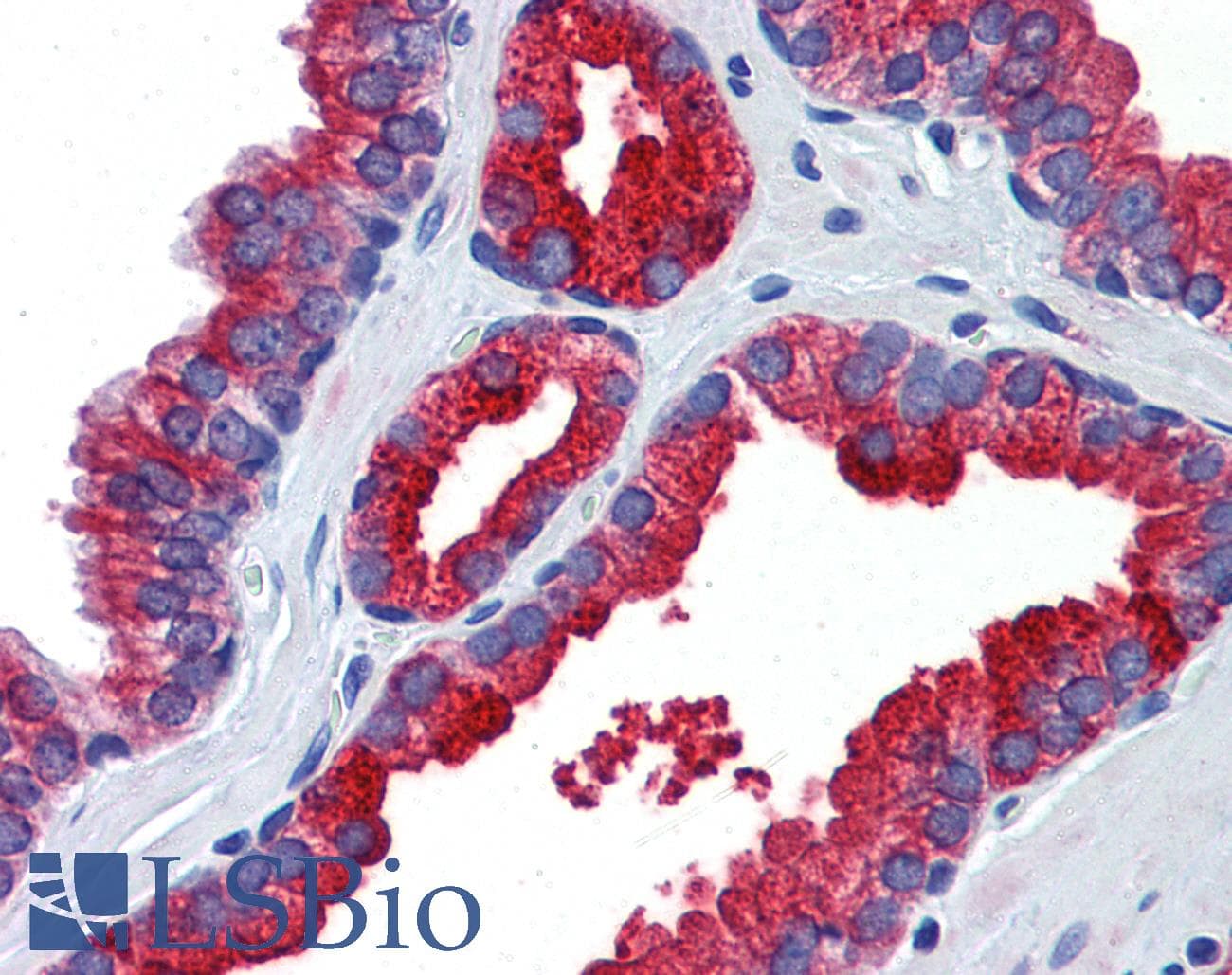 Polyclonal Rabbit anti-Human KL / Klotho Antibody (aa720-769, IHC)