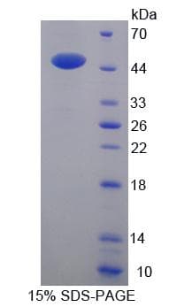 Mouse LSR / LISCH7 Protein (Recombinant His,N-terminus + GST)