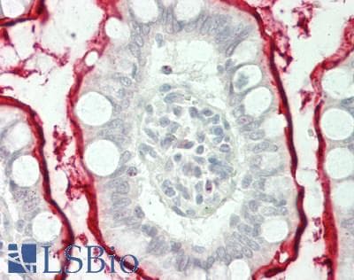 IHC-plus™ Polyclonal Rabbit anti-Human DEFB4A / BD-2 Antibody (Internal, IHC, WB)