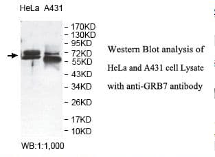 GRB7 Antibody (aa35-201)
