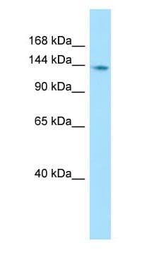 PTPN21 / PTPD1 Antibody (aa981-1030)