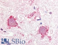 PathPlus™ Polyclonal Rabbit anti-Human TRPA1 Antibody (Internal, IHC, IF)