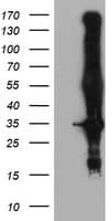 KCNJ3 / GIRK1 Antibody (aa279-501, clone OTI1D3)