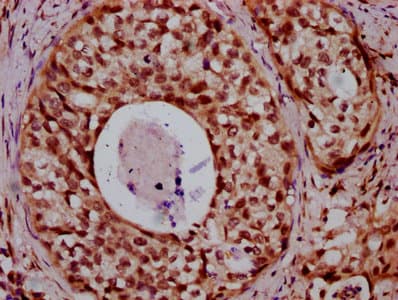HIST1H2BN Antibody