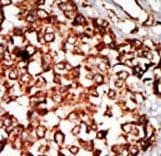 Polyclonal Rabbit anti-Human NRBP1 / NRBP Antibody (aa47-76, IHC, WB)