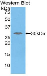 SERPIND1 / Heparin Cofactor 2 Antibody (aa276-499, Biotin)