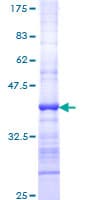 Human DMC1 Protein (Recombinant GST, N-terminus)
