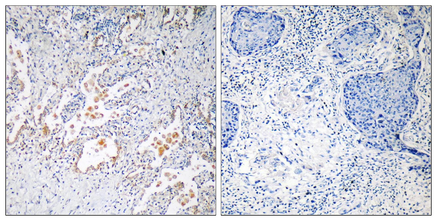 GB5 / GNB5 Antibody
